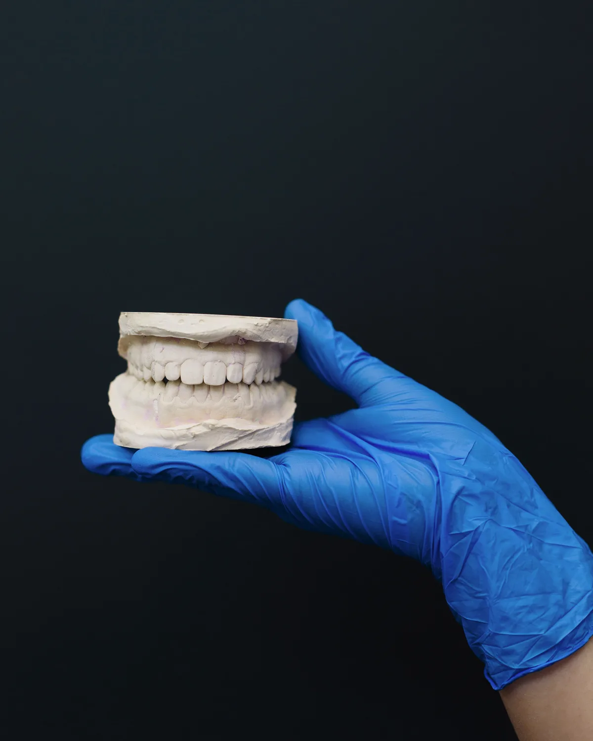 Modelo dental para planificar el diseño de una sonrisa